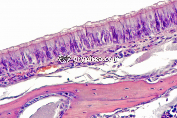Epithélium trachéen x160 - gryphea.com